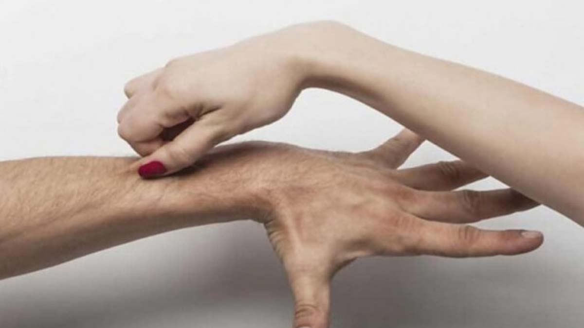 Çimdikleme, boşanma nedeni sayıldı