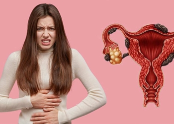'Endometriozis' hastalığına erken teşhis uyarısı