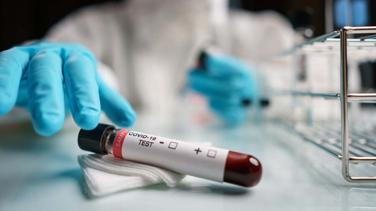 Koronavirüs tablosu 27 Mart 2022