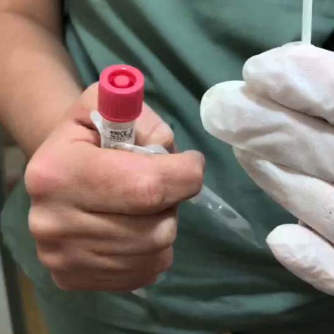 Ankara'da Hacettepe Üniversitesi, kadınların evde rahim ağzı kanseri testi yapabilmesi için kit geliştirdi.