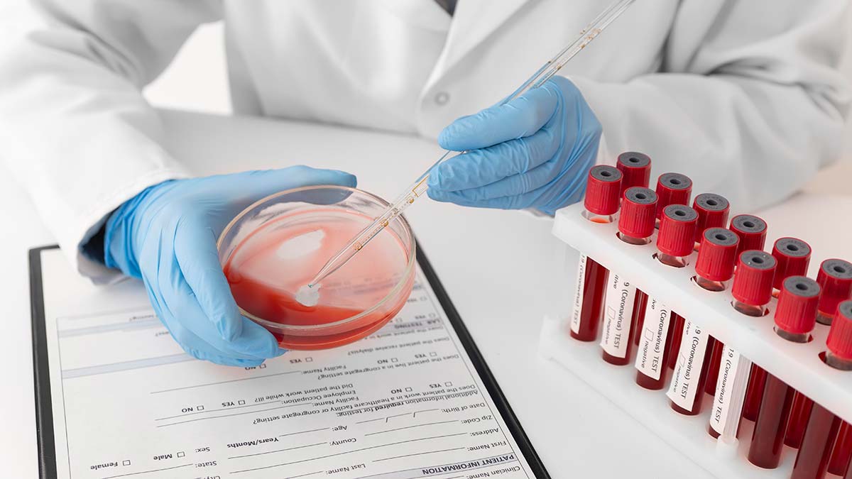 Koronavirüs tablosu 19 Mart 2022