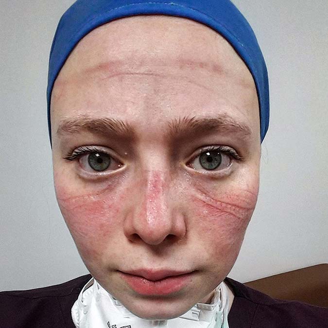 Sağlıkçıların simgesi Seher hemşire; Şiddet bizi üzüyor