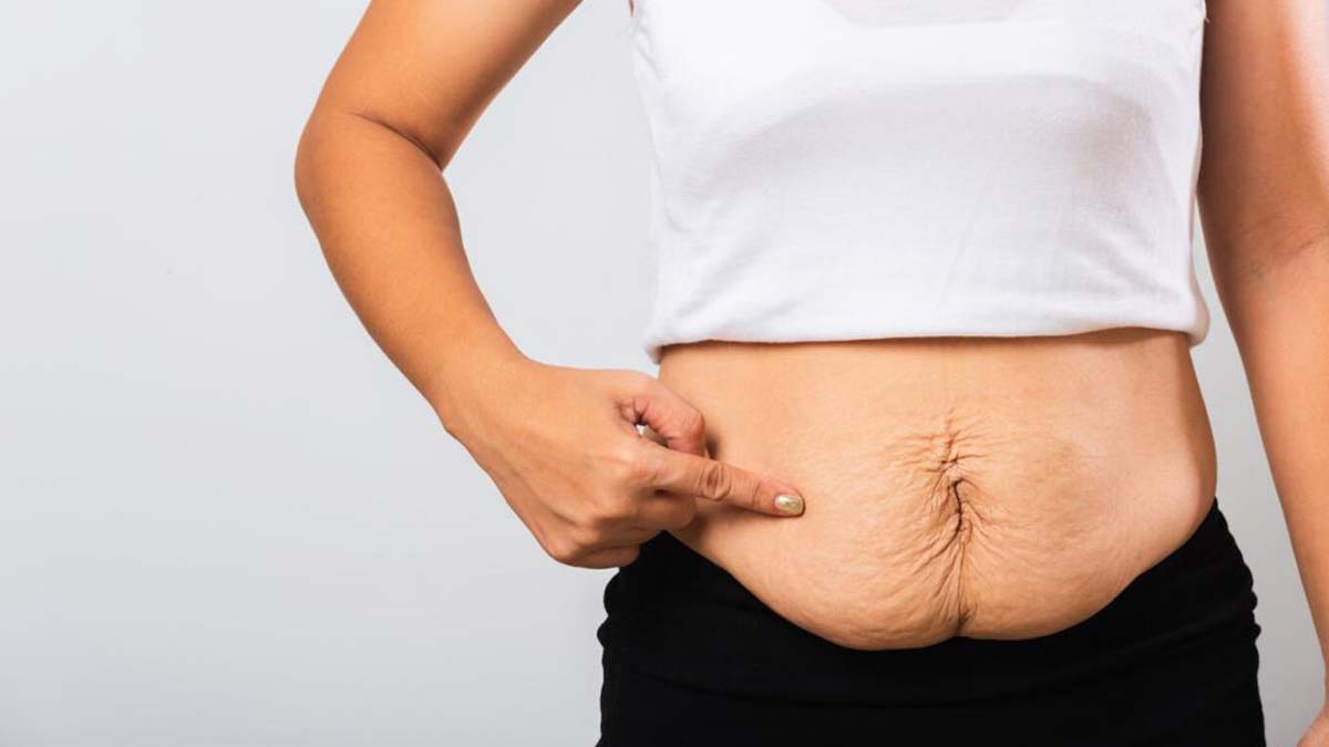 Türkiye'de obezite görülme oranı artıyor