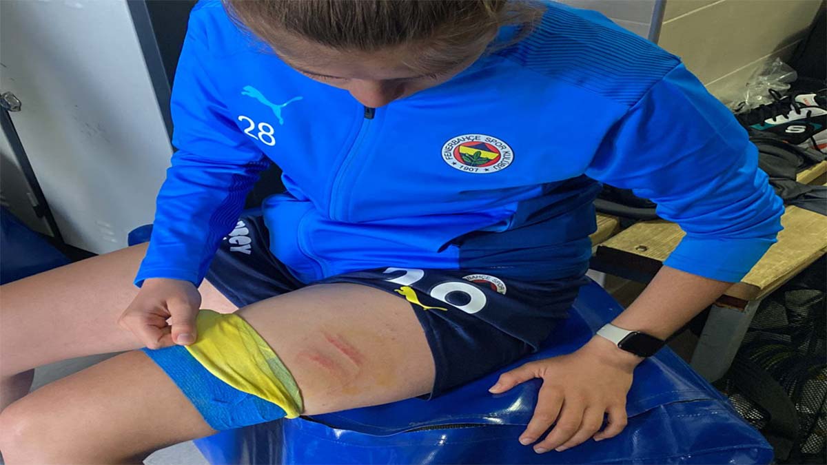 Kadın futbolcular rakiplerine saldırdı!
