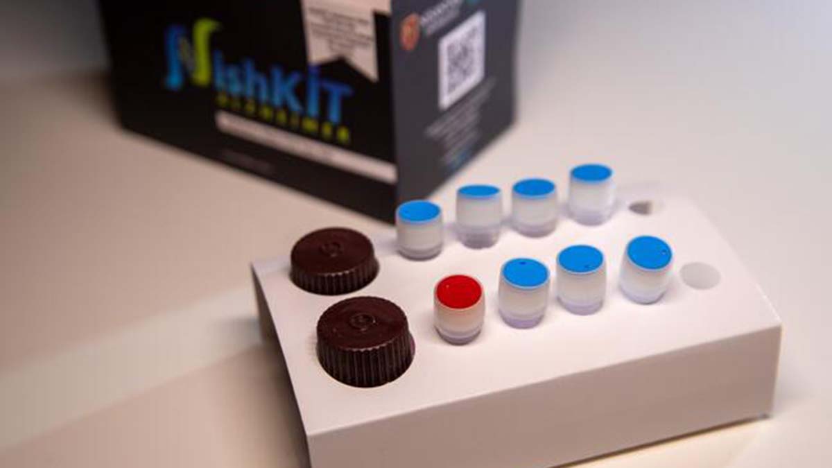 NishKİT Sporadik Alzheimer Riski PCR Tanı Kiti onay aldı