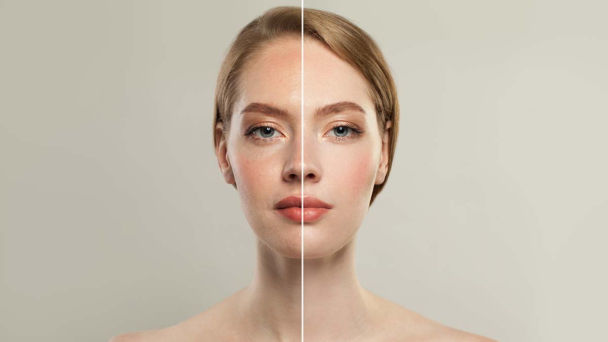 Somon DNA uygulaması cilt sarkmalarında etkili