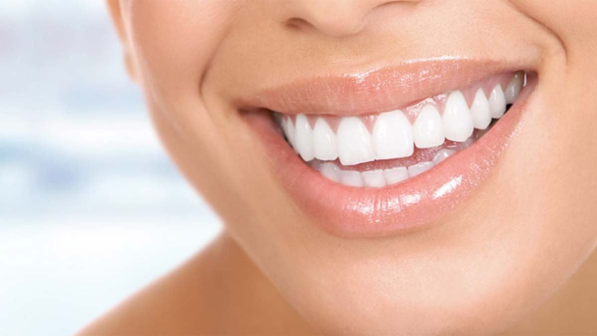 Maskeler kalkınca diş estetiğine rağbet arttı