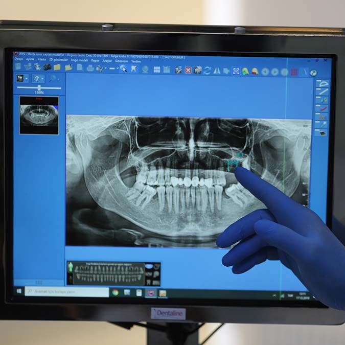 Ağız sağlığına önem verilmiyor