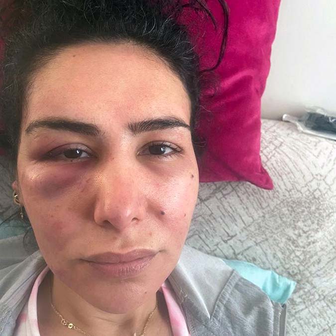 Fide Uyarlar'a saldıran Gökhan K. tutuklandı