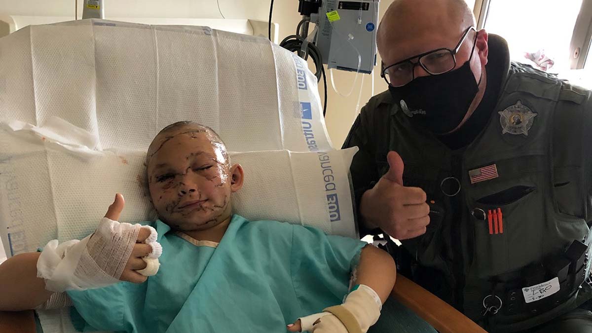 ABD'de 9 yaşındaki kız, puma saldırısına uğradı