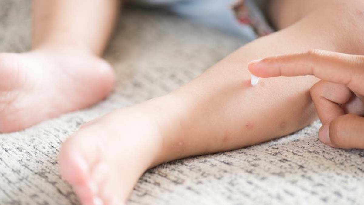 Çocuklarda sık görülen alerjilerin nedenleri