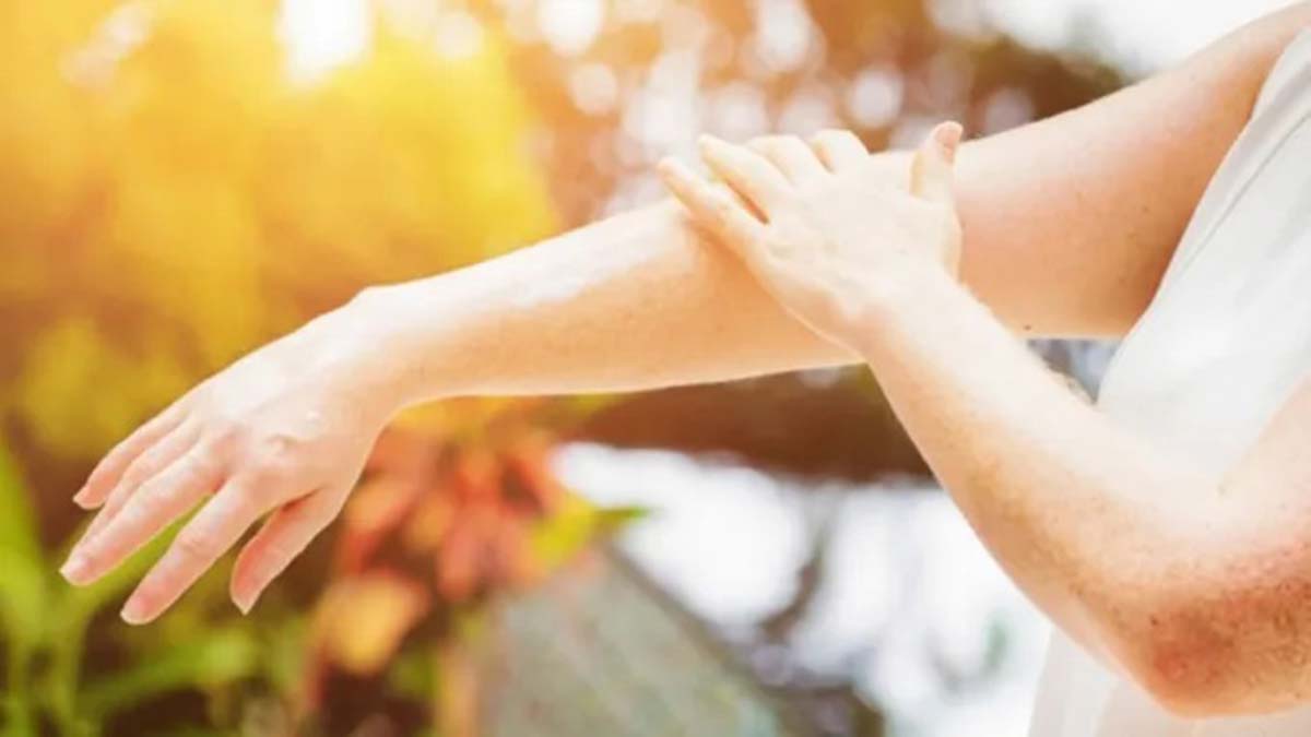 Güneş ışınlarının cilt temasına dikkat