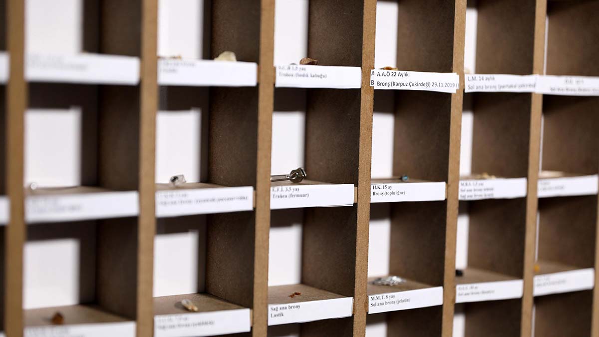 Hastanede 'yutulan cisimler' koleksiyonu