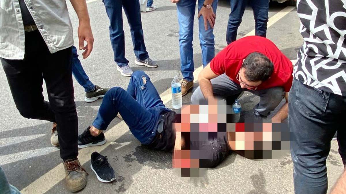 2 aydır yaşam savaşı veren Sipan öldü