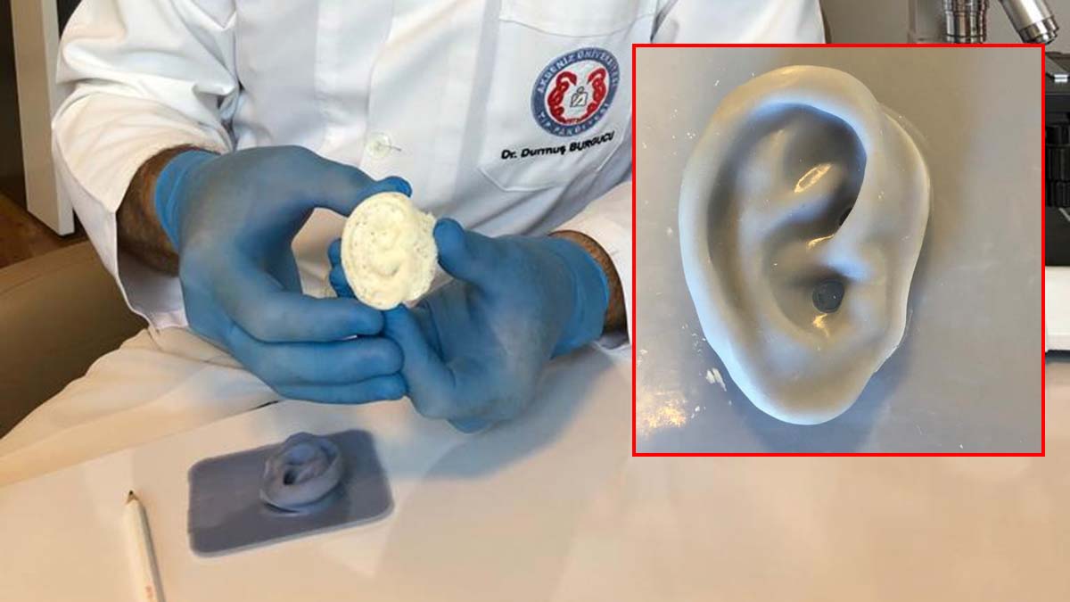 Akdeniz Üniversitesi'nden yapay dokuyla dış kulak