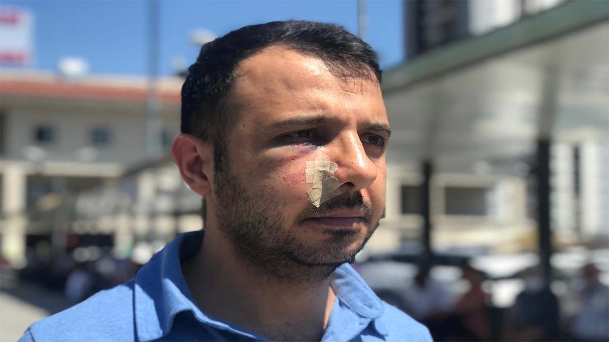 Bağcılar Hastanesi'nde sağlık çalışanına saldırı 