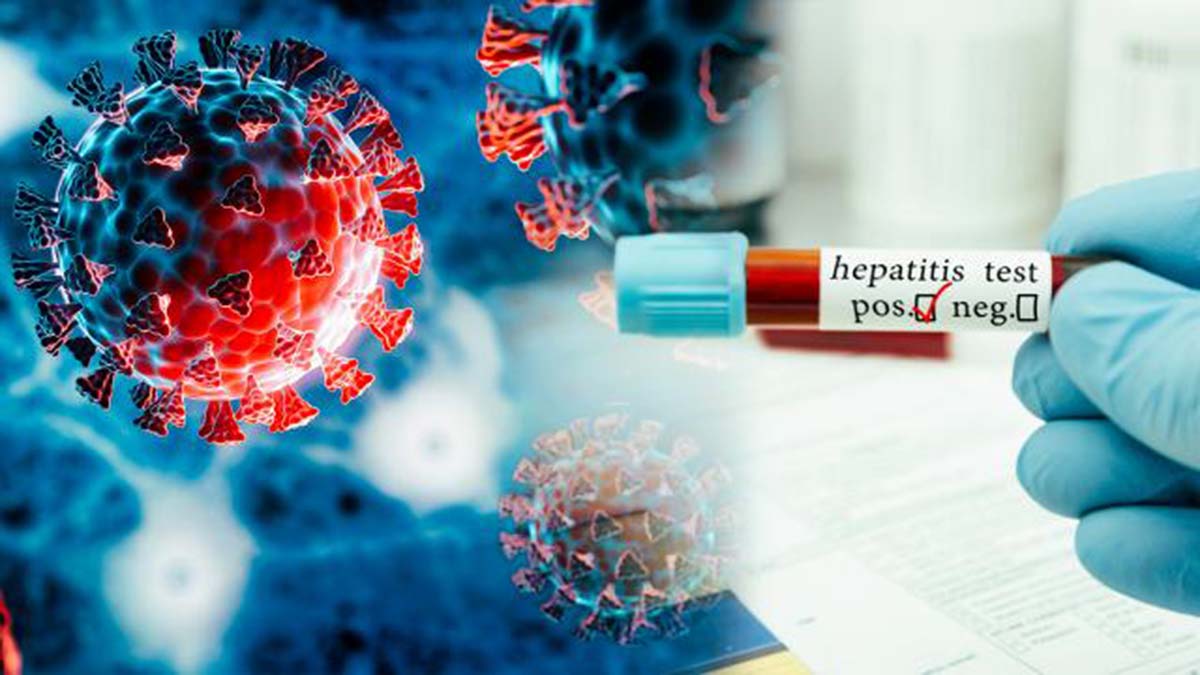 'Gizemli Hepatit en çok çocukları etkiliyor' 