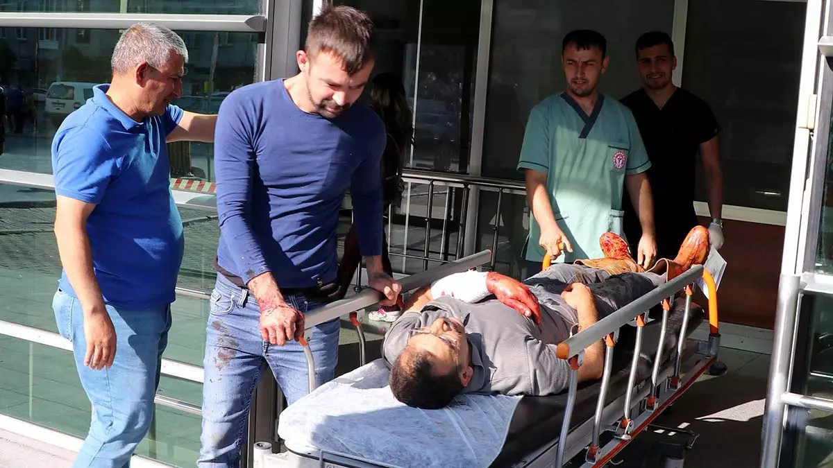 Kayseri'de acemi kasaplar hastaneye koştu