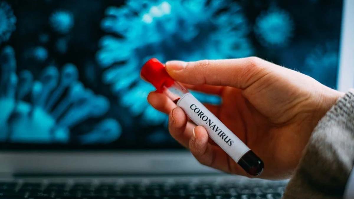 Kovid-19 haftalık vaka sayısı 57 bin 113 oldu