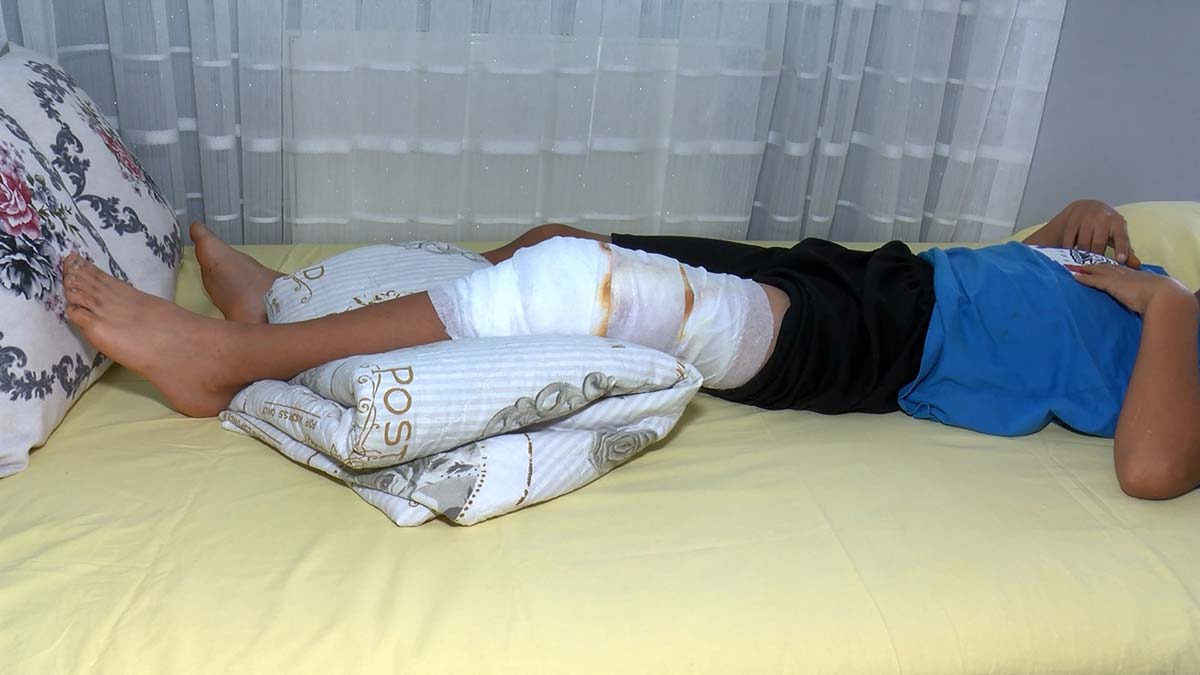 Parkta oynayan çocuğa pitbull saldırdı 