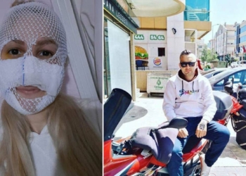 Sultan'ın yüzüne kimyasal atan sanığa 18 yıl hapis