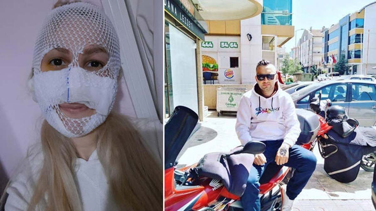 Sultan'ın yüzüne kimyasal atan sanığa 18 yıl hapis