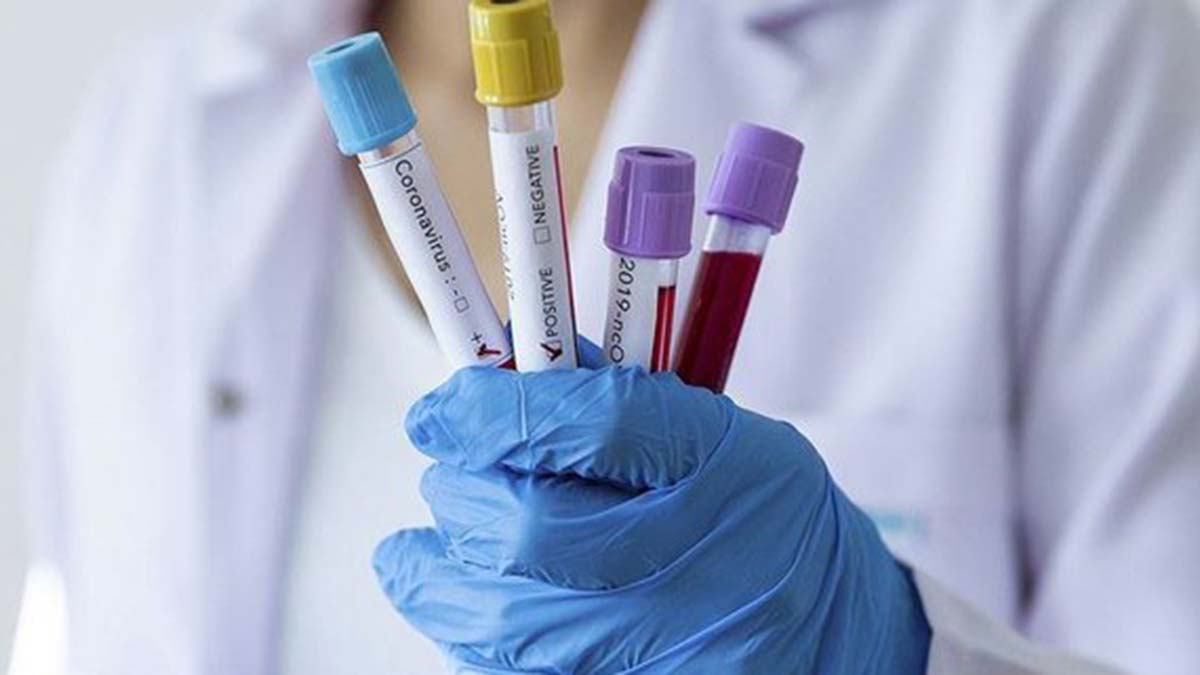 Vaka artışı uzmanları endişelendirdi