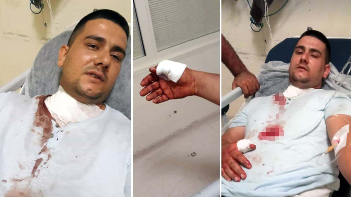 Otomobilini park ederken bıçaklı saldırıya uğradı