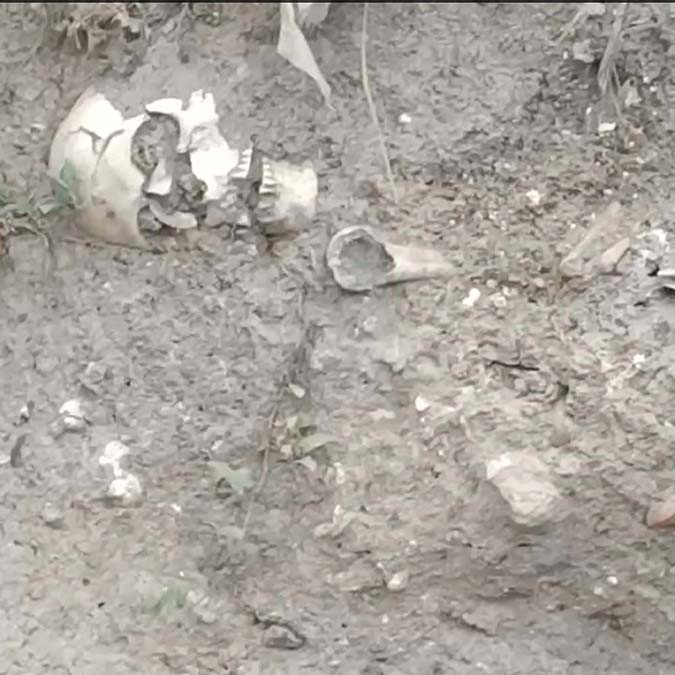 Çankırı'da kafatası ve kemikler bulundu