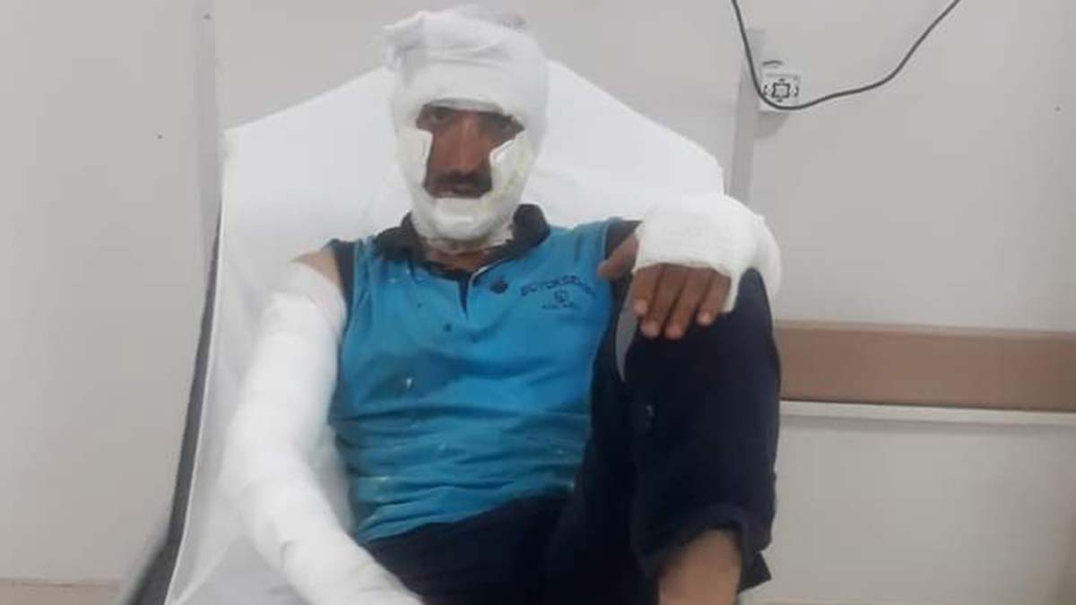 Rögar kapağına kaynak sırasında patlama; 2 yaralı