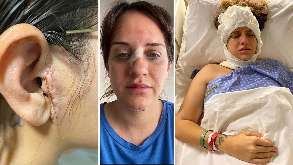 Elektrikli skuter kazalarına dikkat