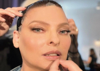 57 yaşındaki modelin yüzü bantlarla gerildi
