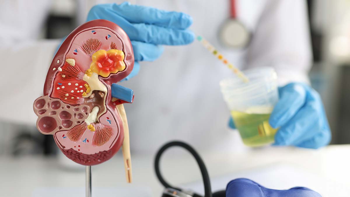 Ailesinde böbrek hastalığı olanlar dikkat