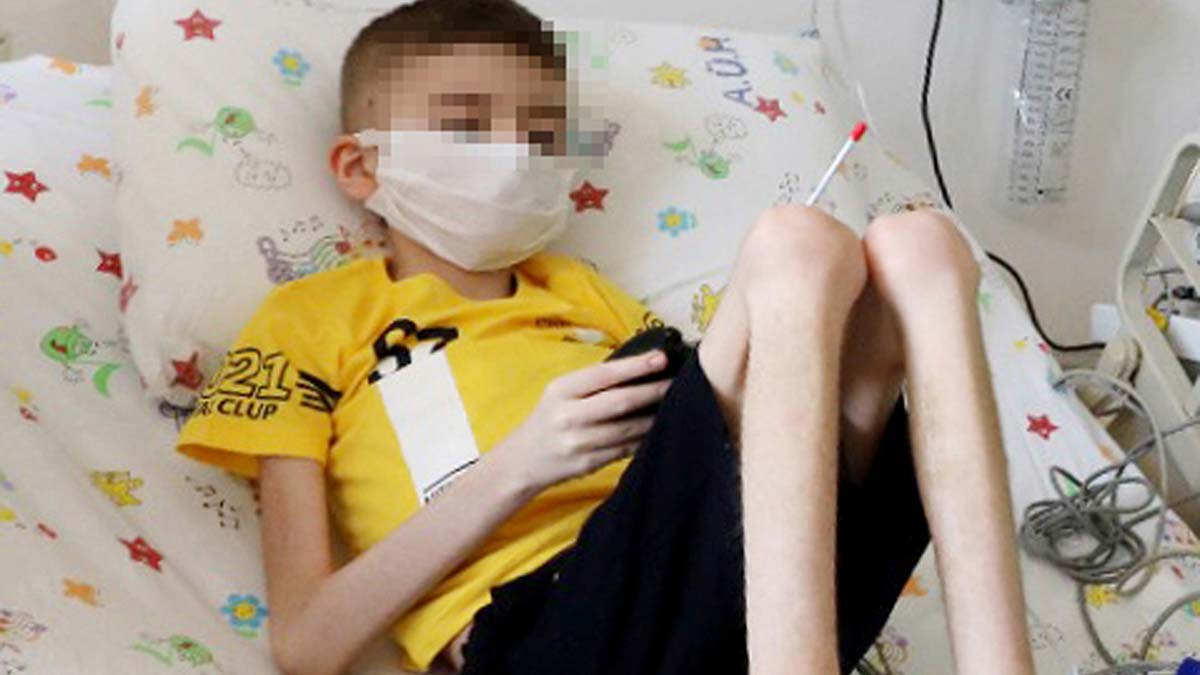 Çöp evden kurtarılan Cem, 20 kiloya ulaştı