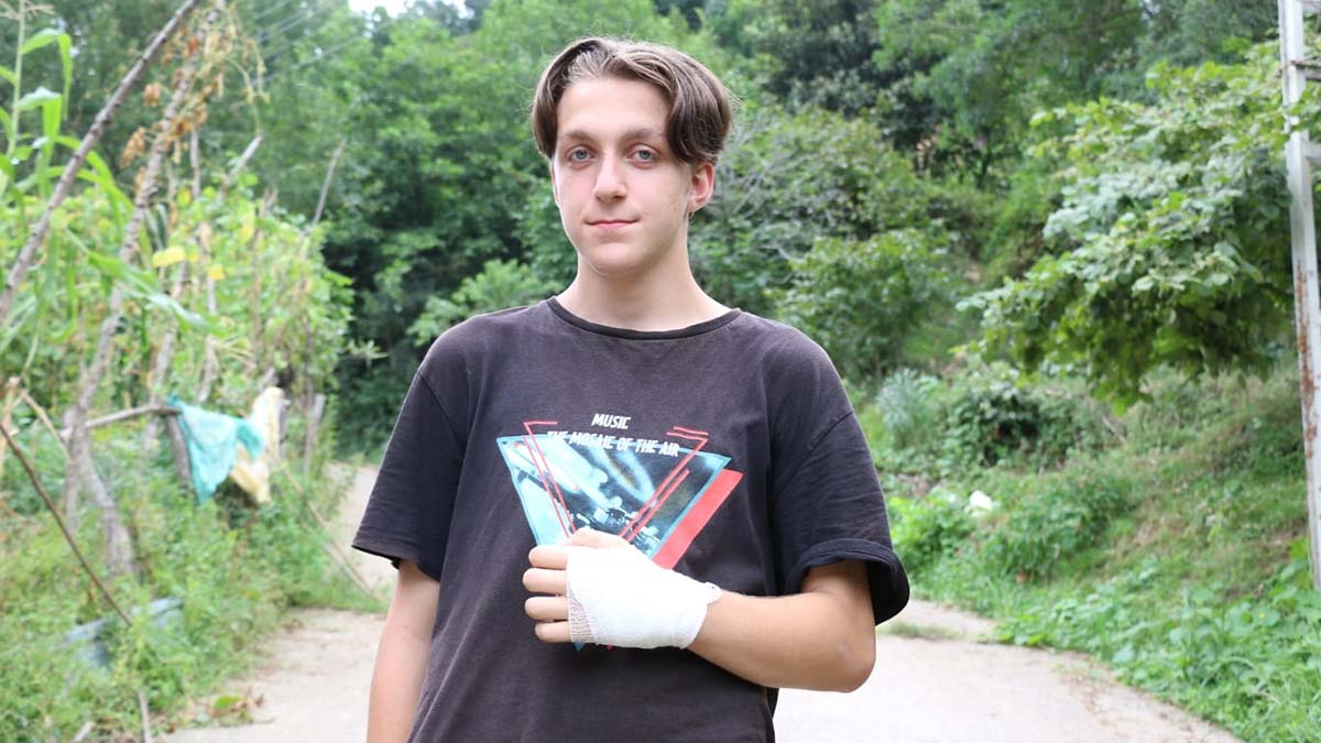 Eline yorgun mermi isabet eden Mehmet yaralandı