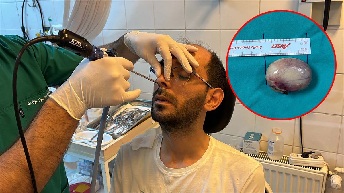 Gırtlağından yumruk büyüklüğünde kitle çıktı