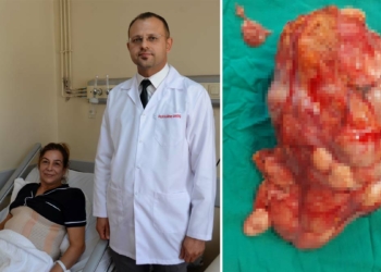 Karnından, 10 kiloluk kanserli kitle çıkarıldı