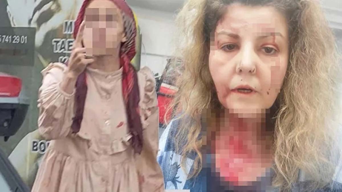 Kediye tekme kavgası