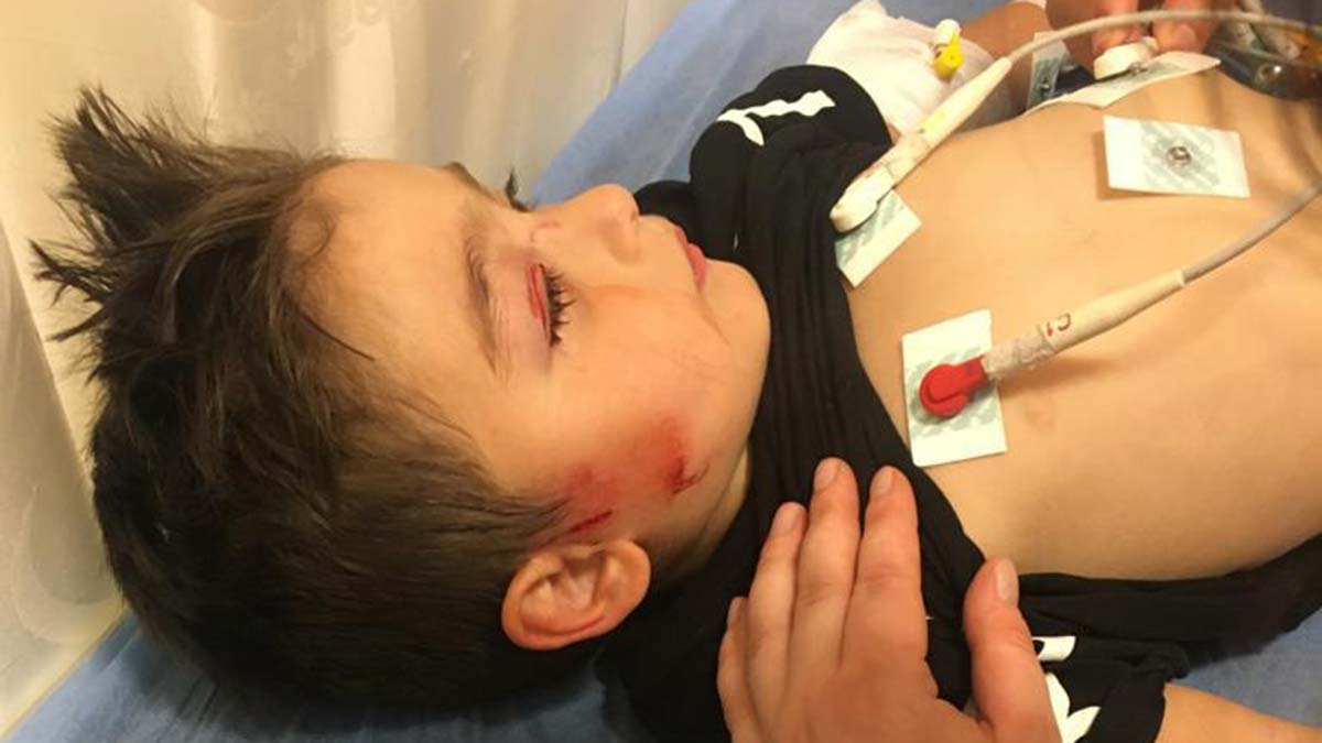 Köpeğin saldırdığı Miraç yaralandı