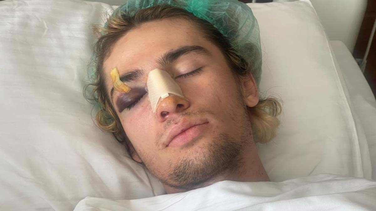 Milli sporcu Alparslan Ayhan'a dayak