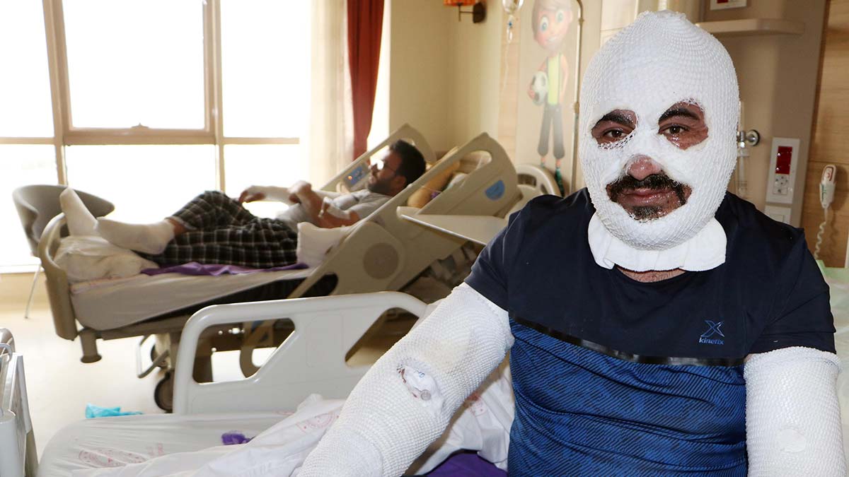 Otogaz bakım dükkanında patlama