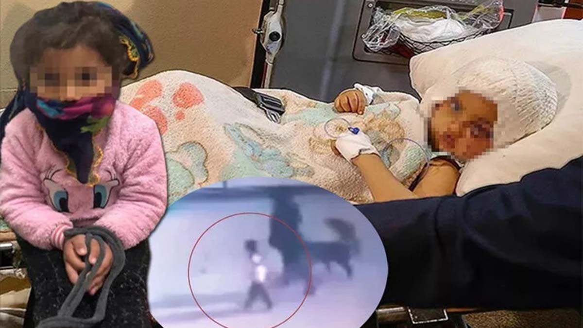 Pitbull saldırısında yaralanan Asiye'ye psikolojik şiddet