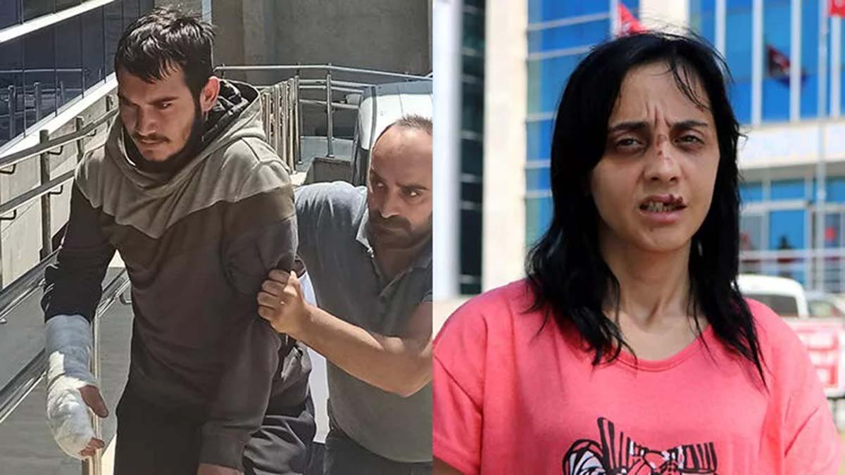 Tanımadığı kadına yumruk atıp, dişlerini kırdı