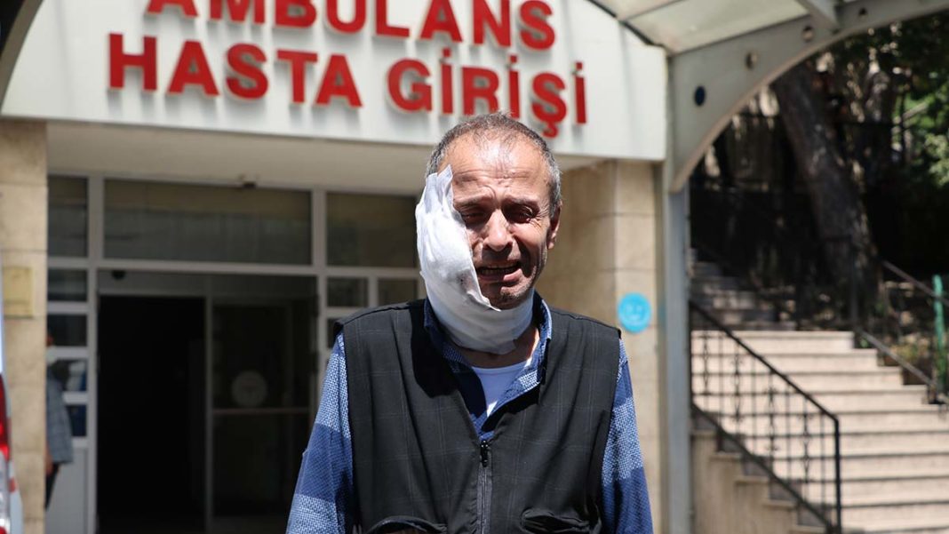 Zonguldak'ta tartıştığı komşusunun boğazını kesti
