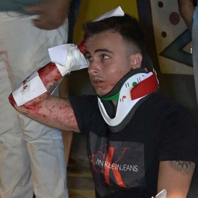 Otomobil ağaçları sulayan tankere çarptı; 5 yaralı