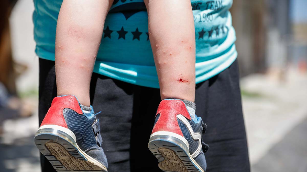 İstanbul'da Aedes türü sivrisineklerde artış yaşanıyor. Özellikle zika virüsü bulaştıran 'Aedes' türü sivrisineklerle mücadelede ilaçlamanın yeterli olmadığı belirtiliyor.