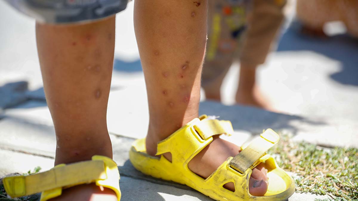 İstanbul'da Aedes tehlikesi