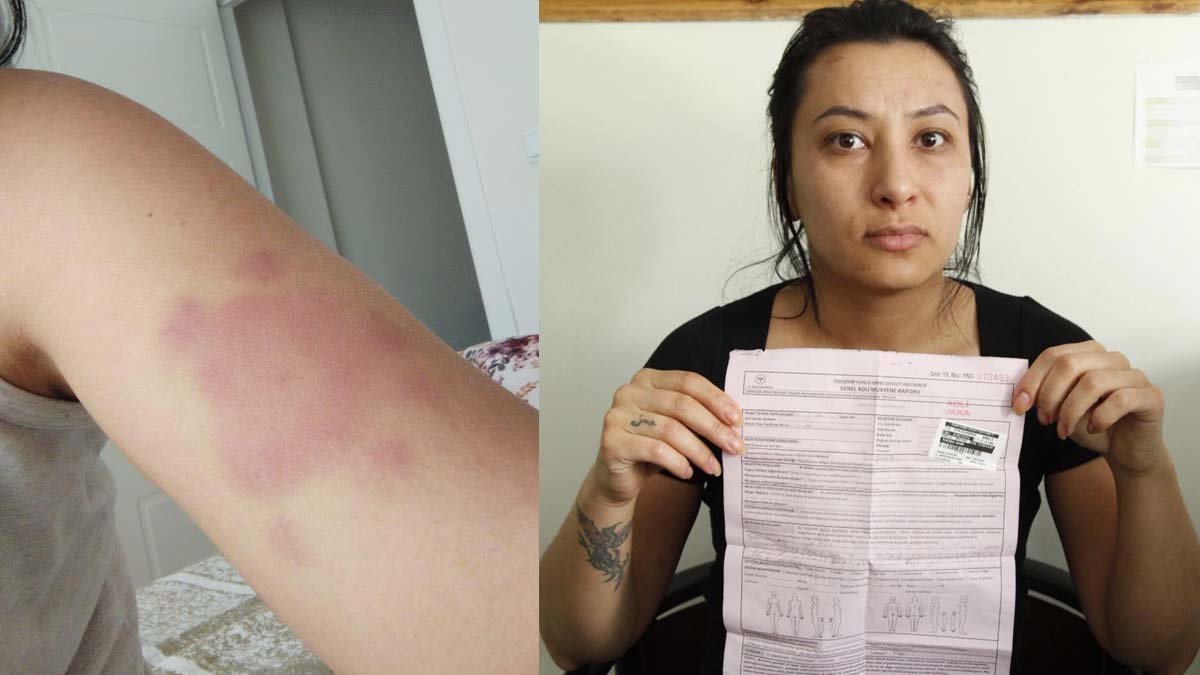 Tuğba'yı döven eski koca kasten yaralama suçundan tutuklandı