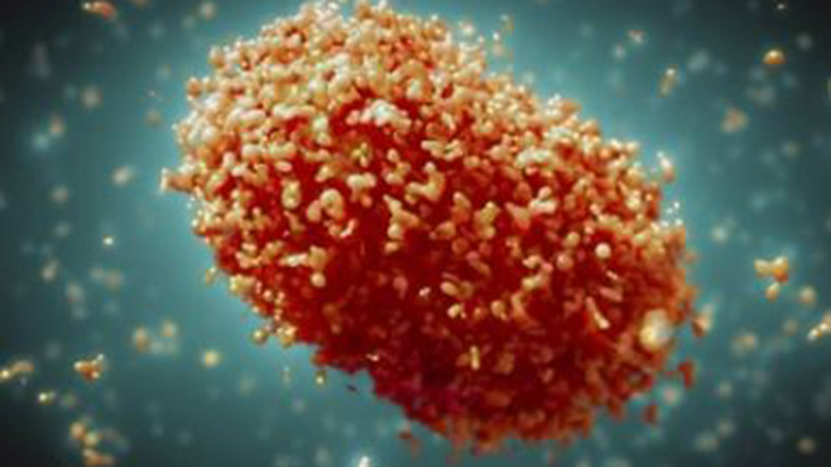 ABD'de maymun çiçeği virüsü kaynaklı ilk ölüm