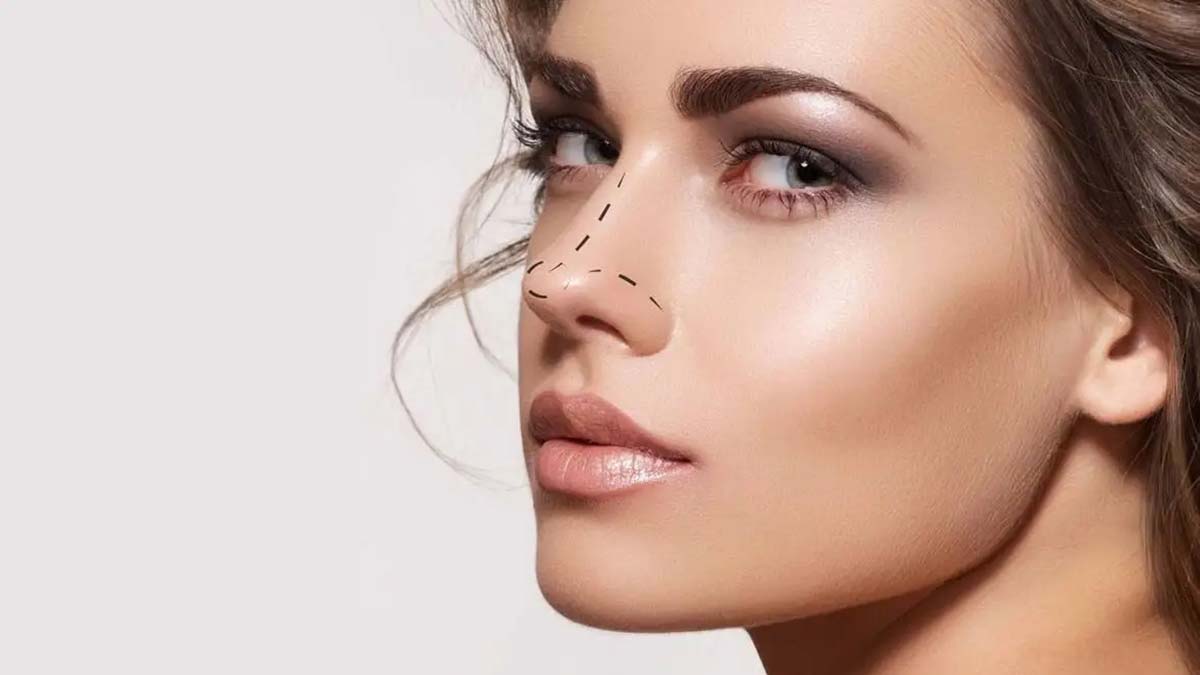 Burun estetiğinde kemiği kırmadan tedavi mümkün